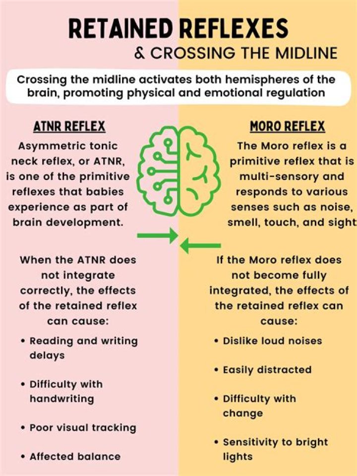 What are reflexes like with MS?