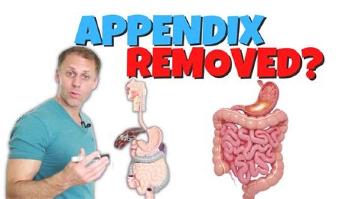 What are signs of your appendix needing to be removed?