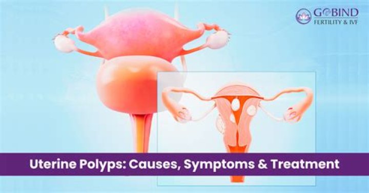 What are the chances that a uterine polyp is cancerous?