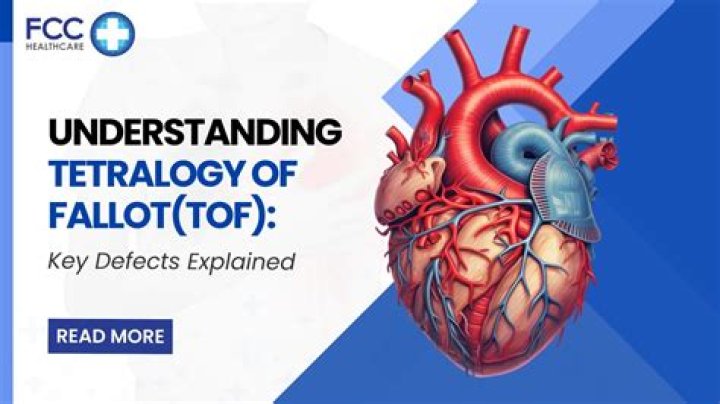 What are the components of tetralogy of Fallot?