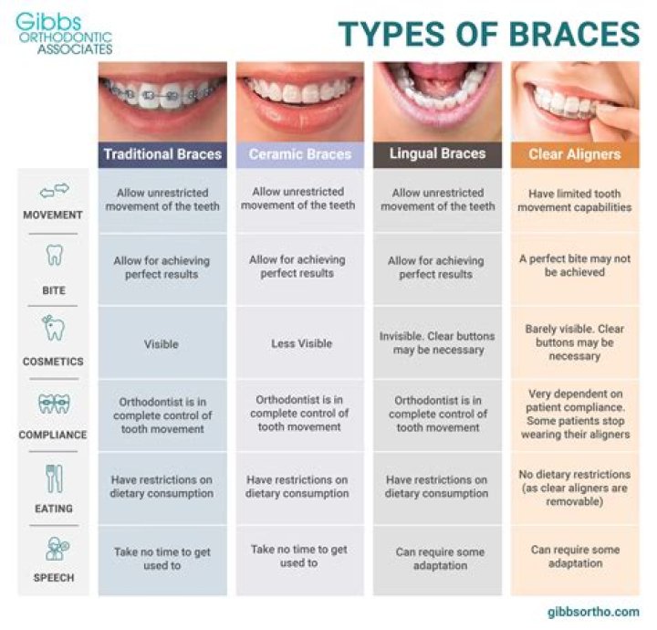 What are the different types of brackets for braces?