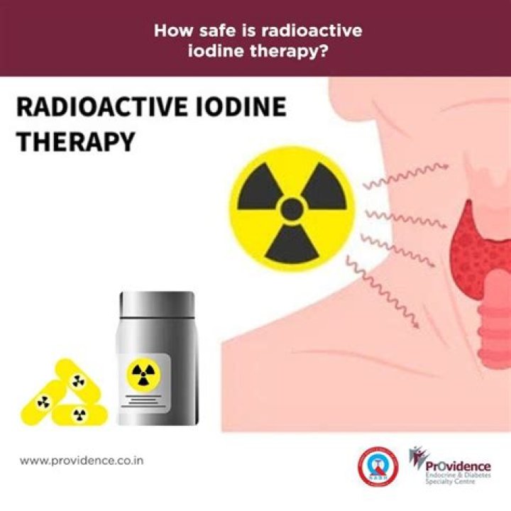 What are the long term side effects of radioactive iodine therapy?