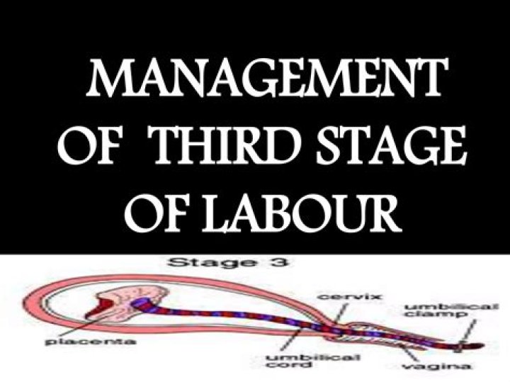 What are the management of third stage of Labour?