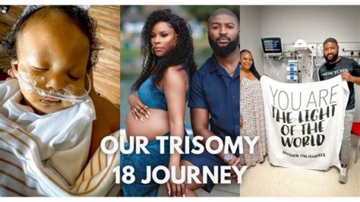 What are the odds of having a baby with trisomy 18?