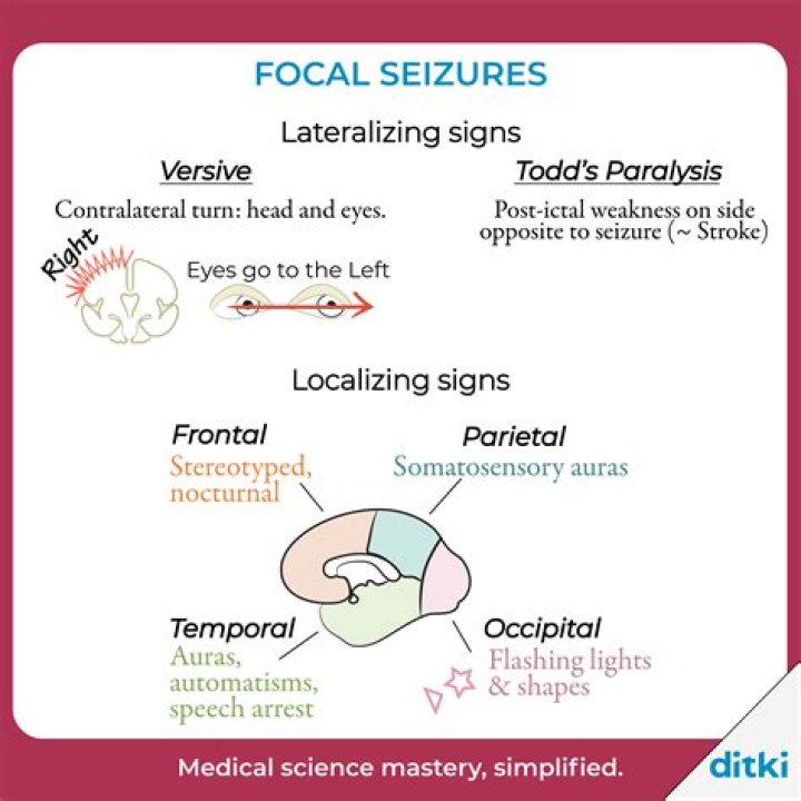 What are the symptoms of a focal seizure?