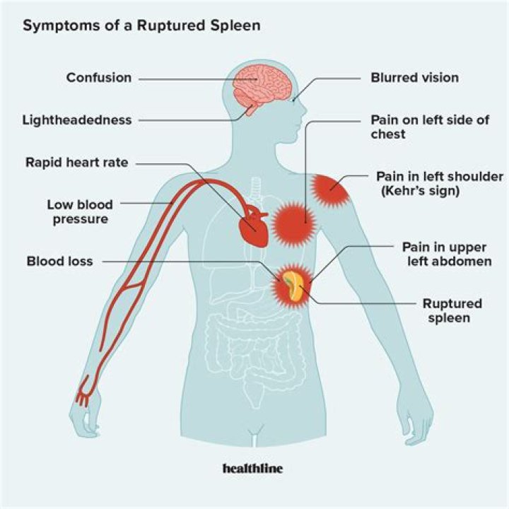 What are the symptoms of osteoma?