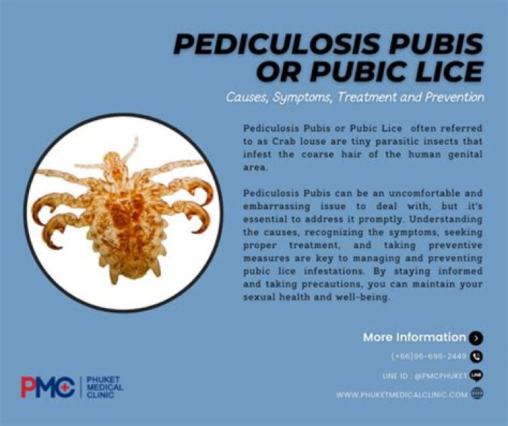 What are the symptoms of pediculosis pubis?