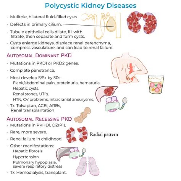 What are the symptoms of PKD?