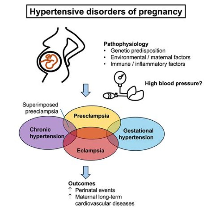 What are the three classic signs and symptoms of pregnancy-induced hypertension?