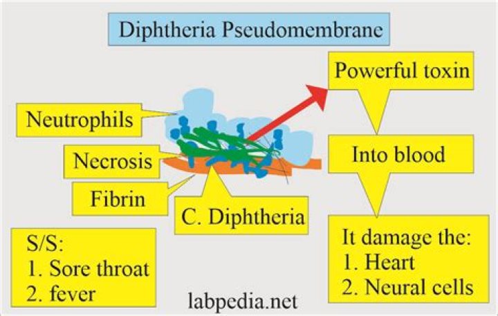 What bacteria causes pseudomembrane?