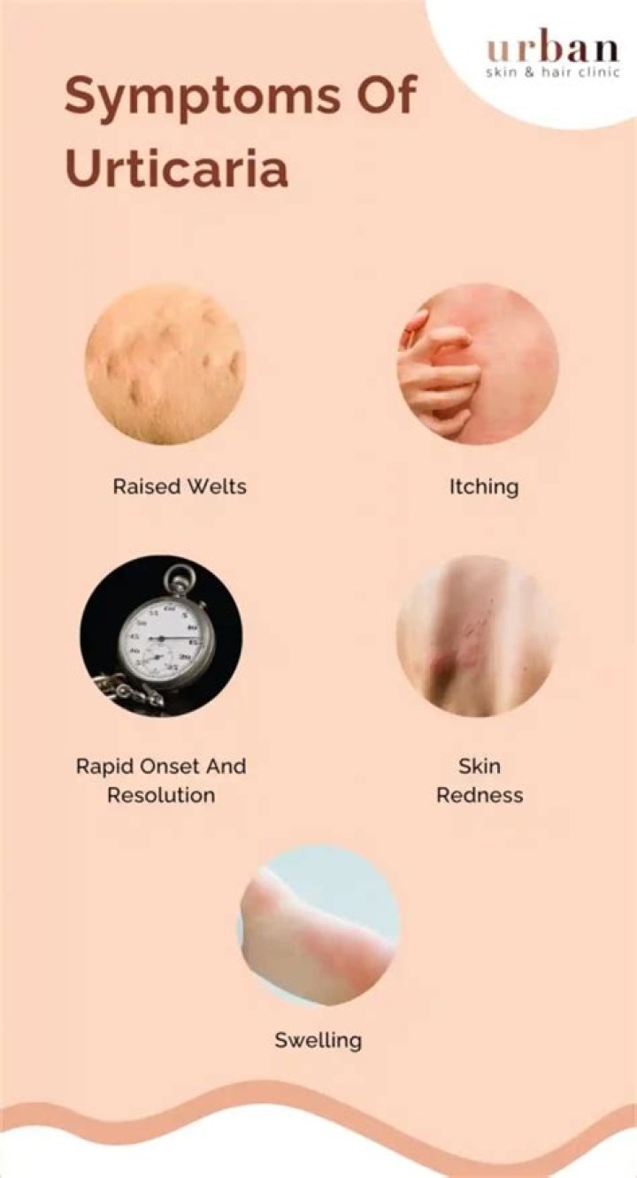 What blood condition causes cold urticaria?