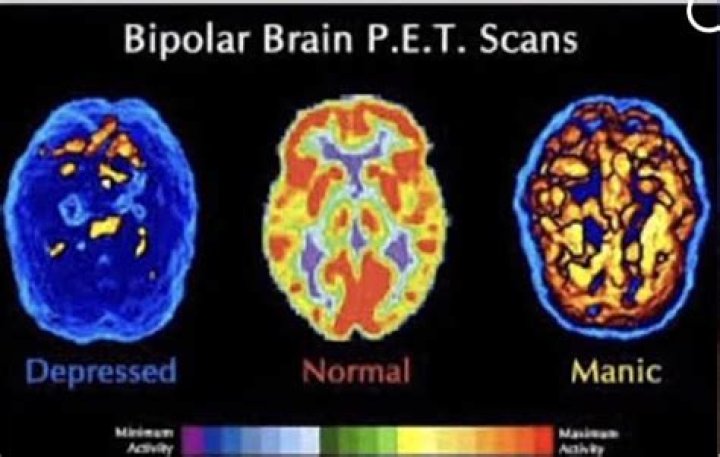 What brain function is disrupted in bipolar?