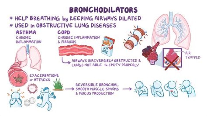 What can cause paradoxical bronchospasm?