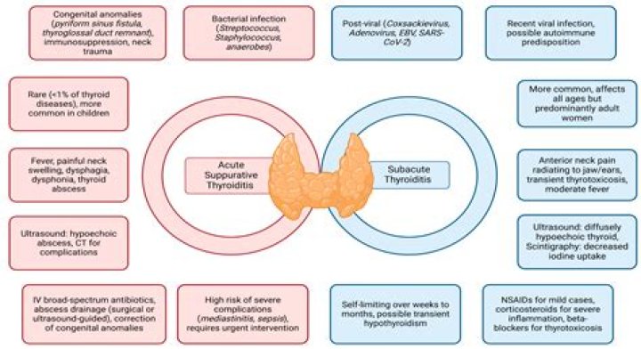 What can cause subacute thyroiditis?