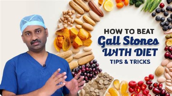 What can I eat with gallstones UK?