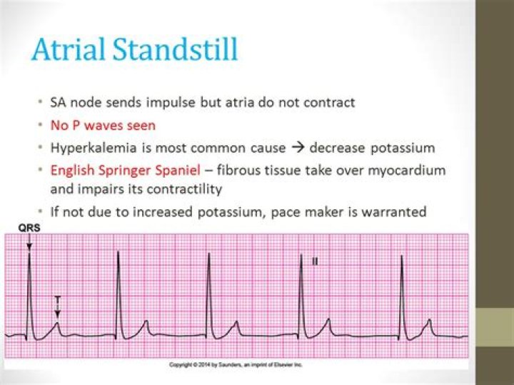What causes atrial standstill?