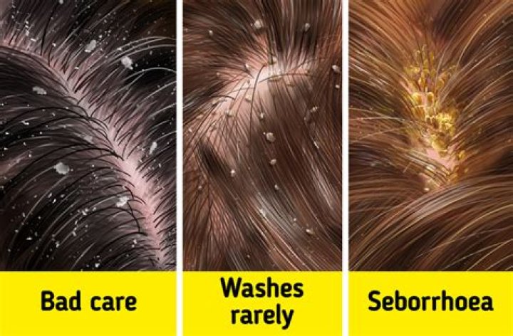 What causes bad hair days?