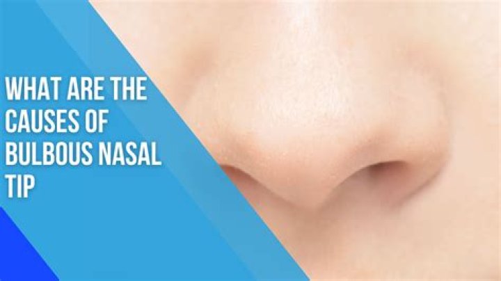 What causes bulbous papilla?