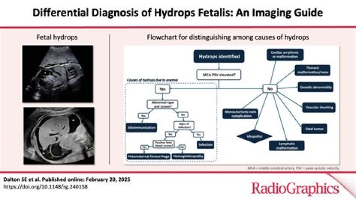 What causes fetal loss?
