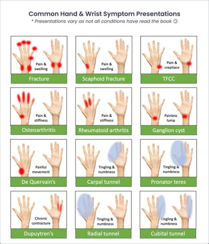 What causes hand to contort?
