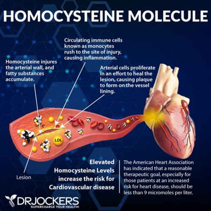 What causes homocysteine levels to rise?