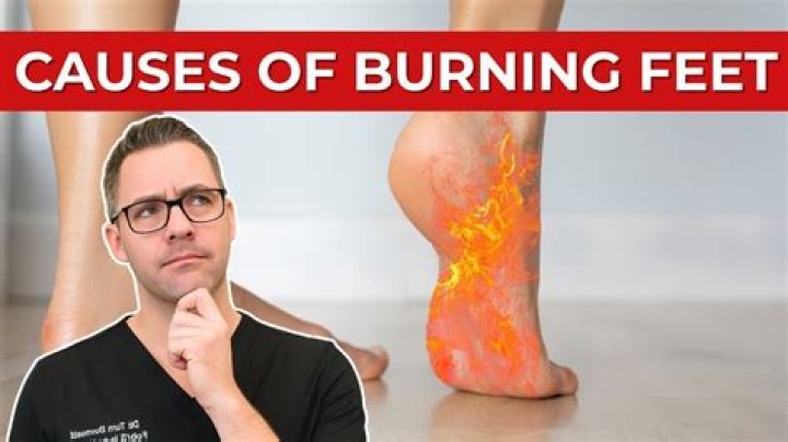 What causes hot burning legs at night?