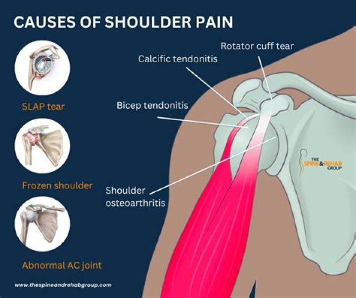 What causes left shoulder stiffness?