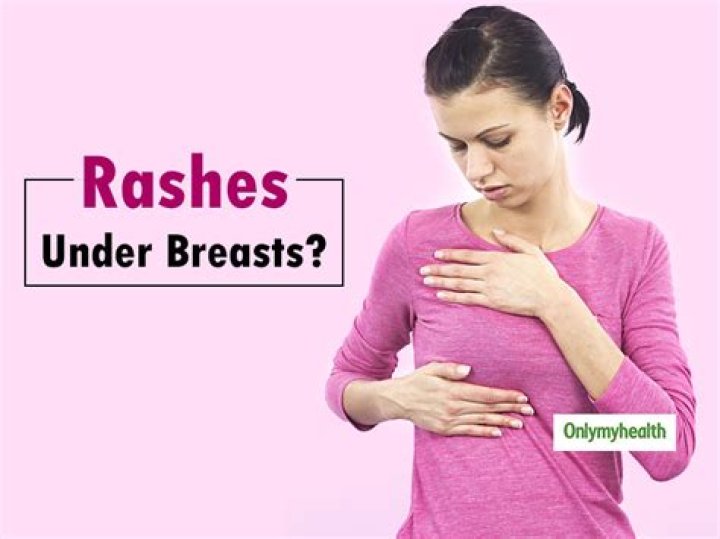 What causes red itchy rash under breasts?