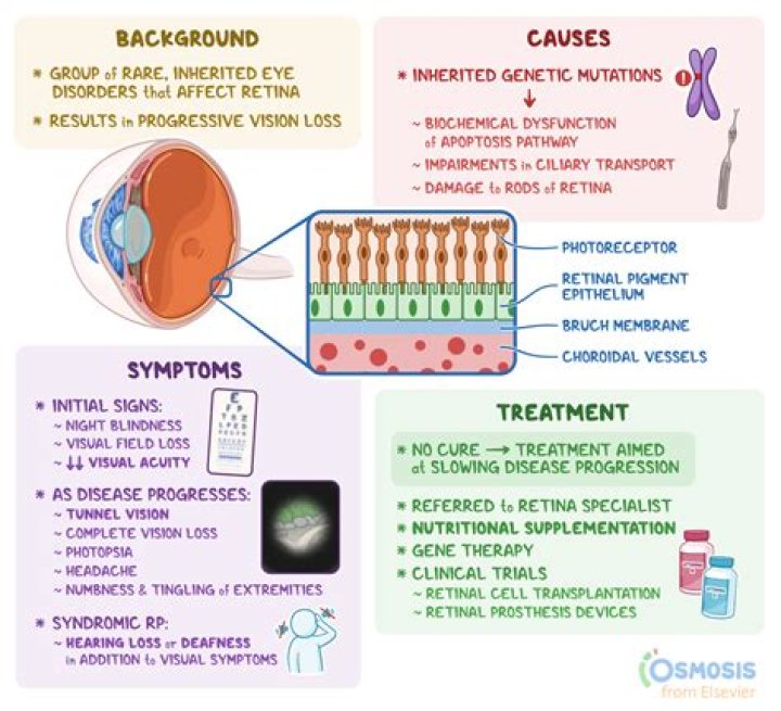 What causes retinal toxicity?
