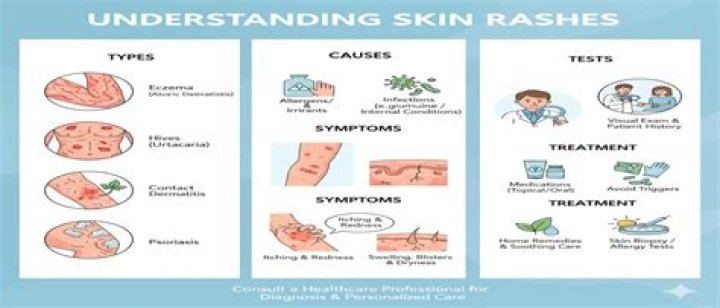 What causes skin sensitivities?