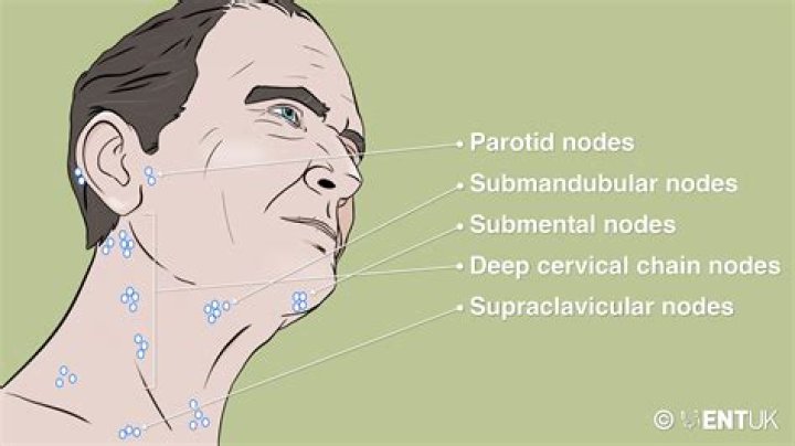 What causes swollen posterior auricular lymph nodes?