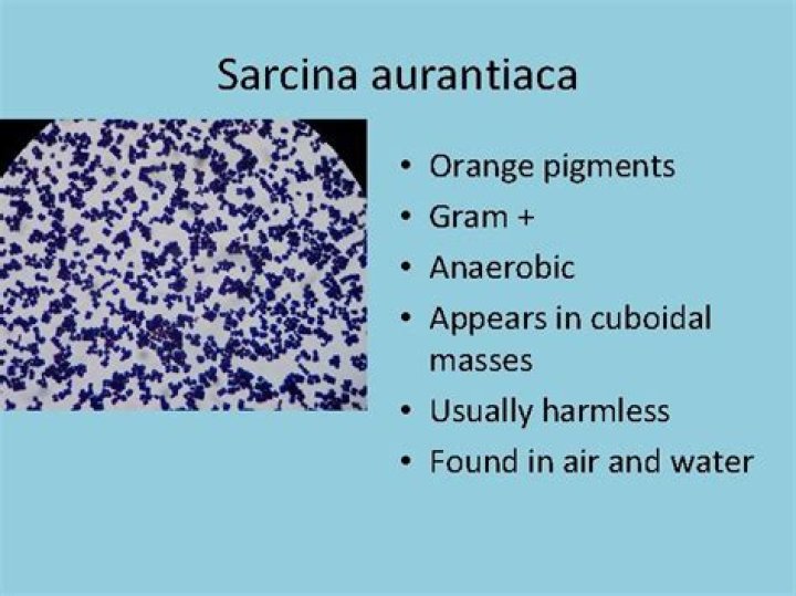What color is Sarcina Aurantiaca?