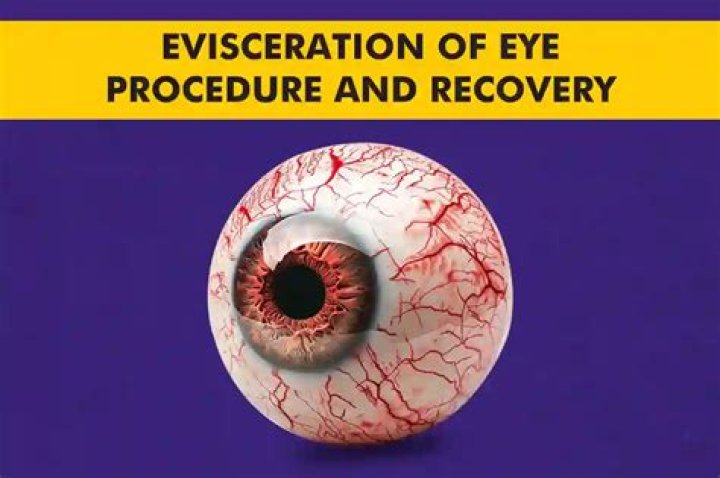 What comes from after the evisceration?