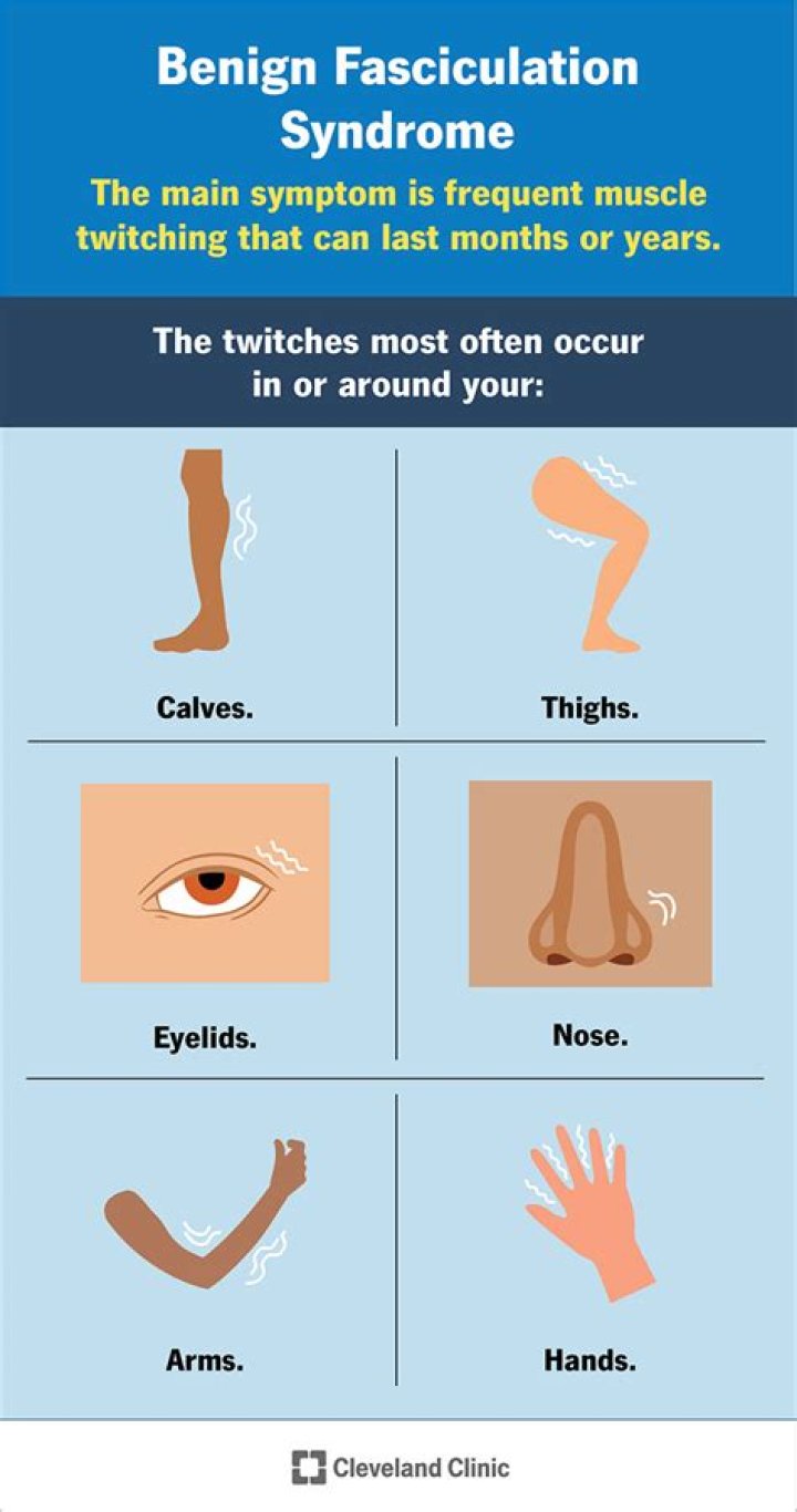 What do ALS Fasciculations feel like?