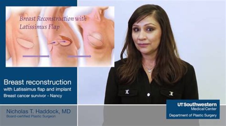 What do breasts look like after a reduction?