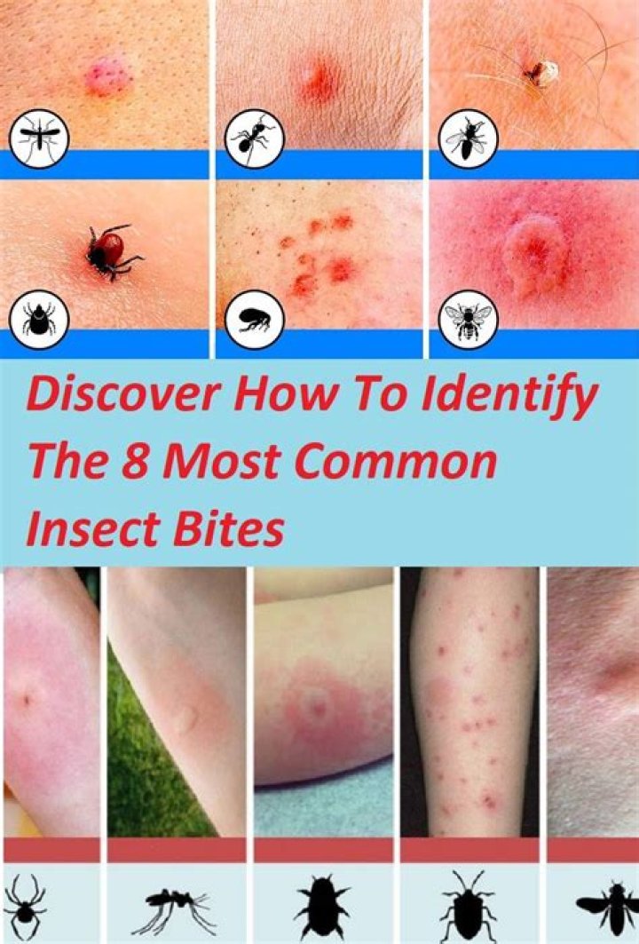 What do mosquito bites look like on humans?
