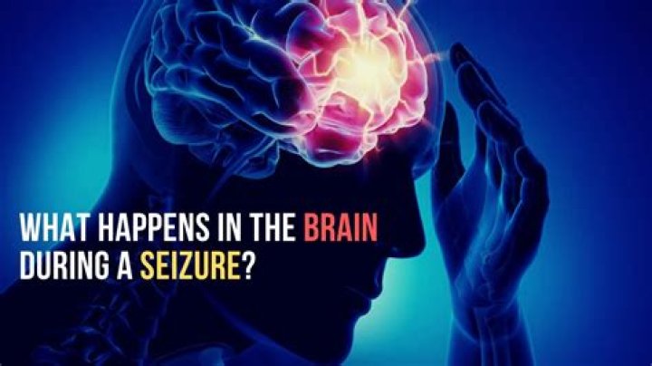 What do you do for an eclamptic seizure?