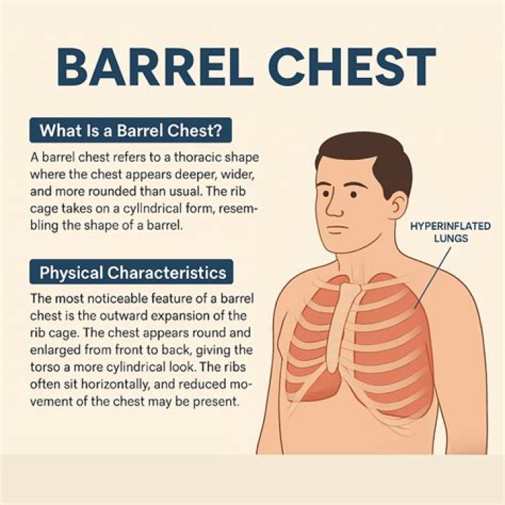 What does a COPD barrel chest look like?