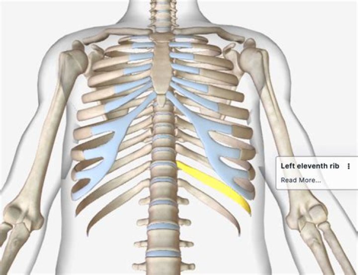 What does a dislocated rib feel like?