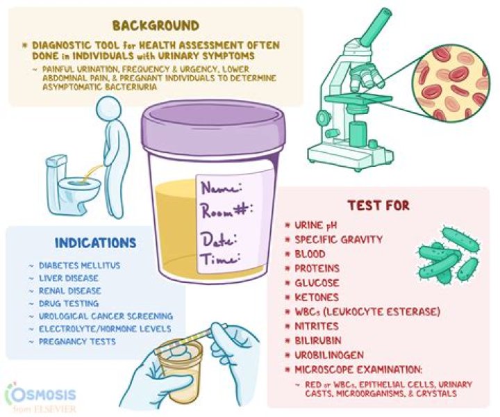 What does a positive urine FISH test mean?