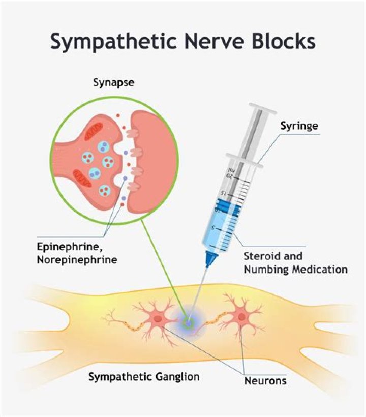 What does a sympathetic nerve block feel like?