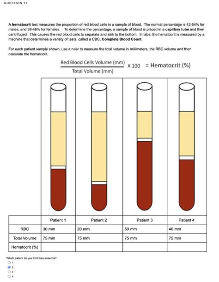 What does an erythropoietin blood test show?