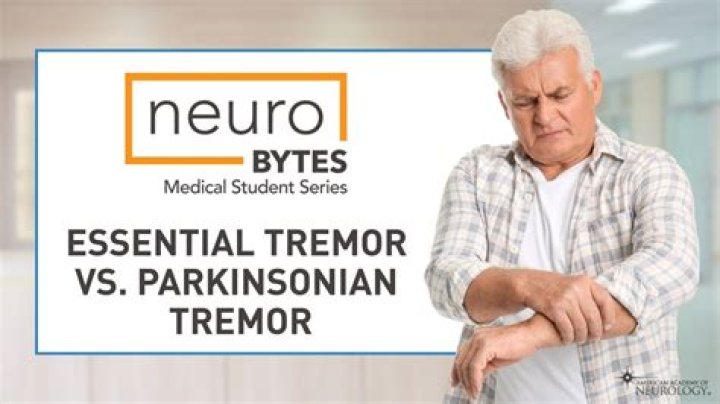 What does an essential tremor look like?
