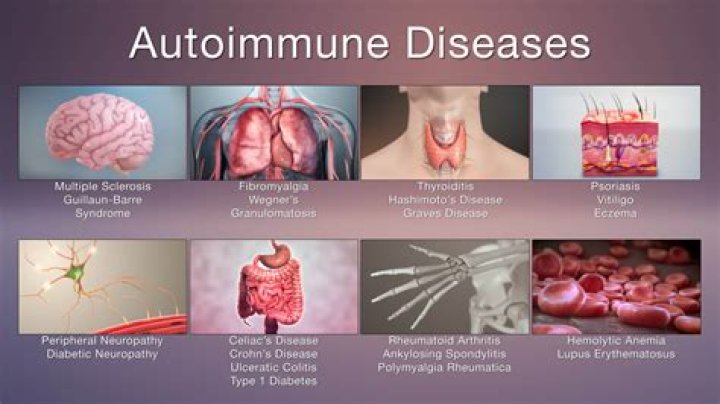 What does autoimmune brain fog feel like?