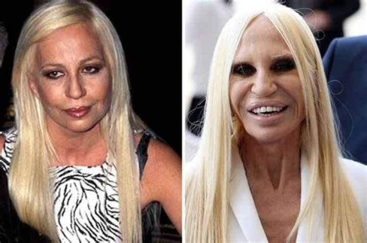 What does Botched surgery mean?