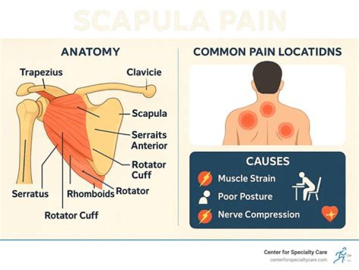 What does bursitis in the scapula feel like?