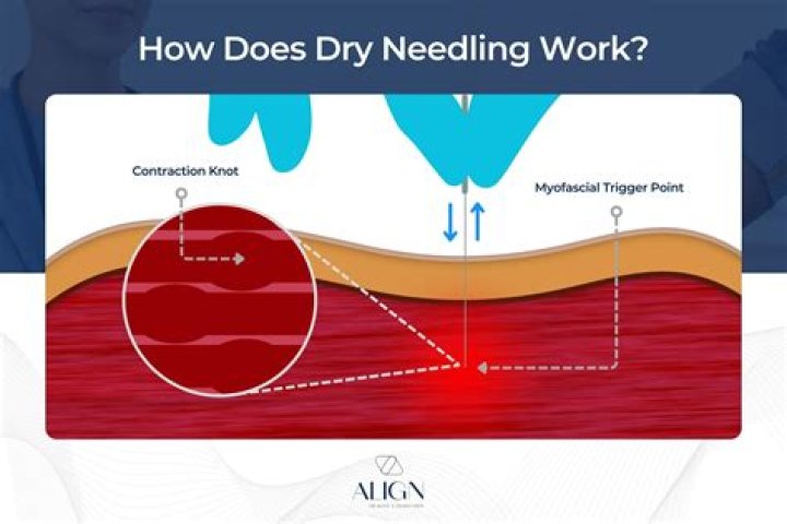 What does dry hire include?