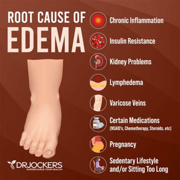 What does edema look like in plants?
