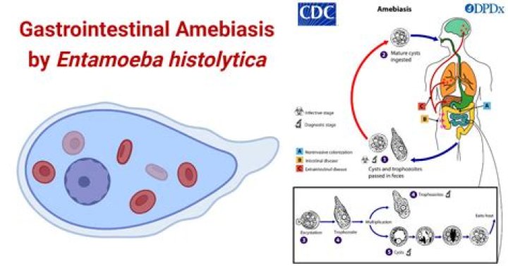 What does Entamoeba histolytica cause?