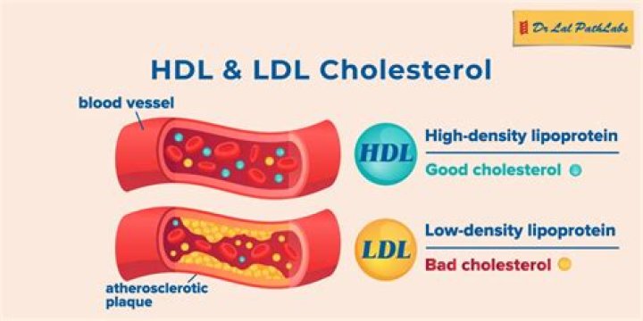 What does HDL mg dL mean?